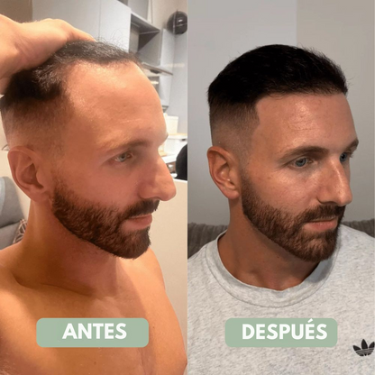 Bodywise™ Sérum para el Crecimiento del Cabello