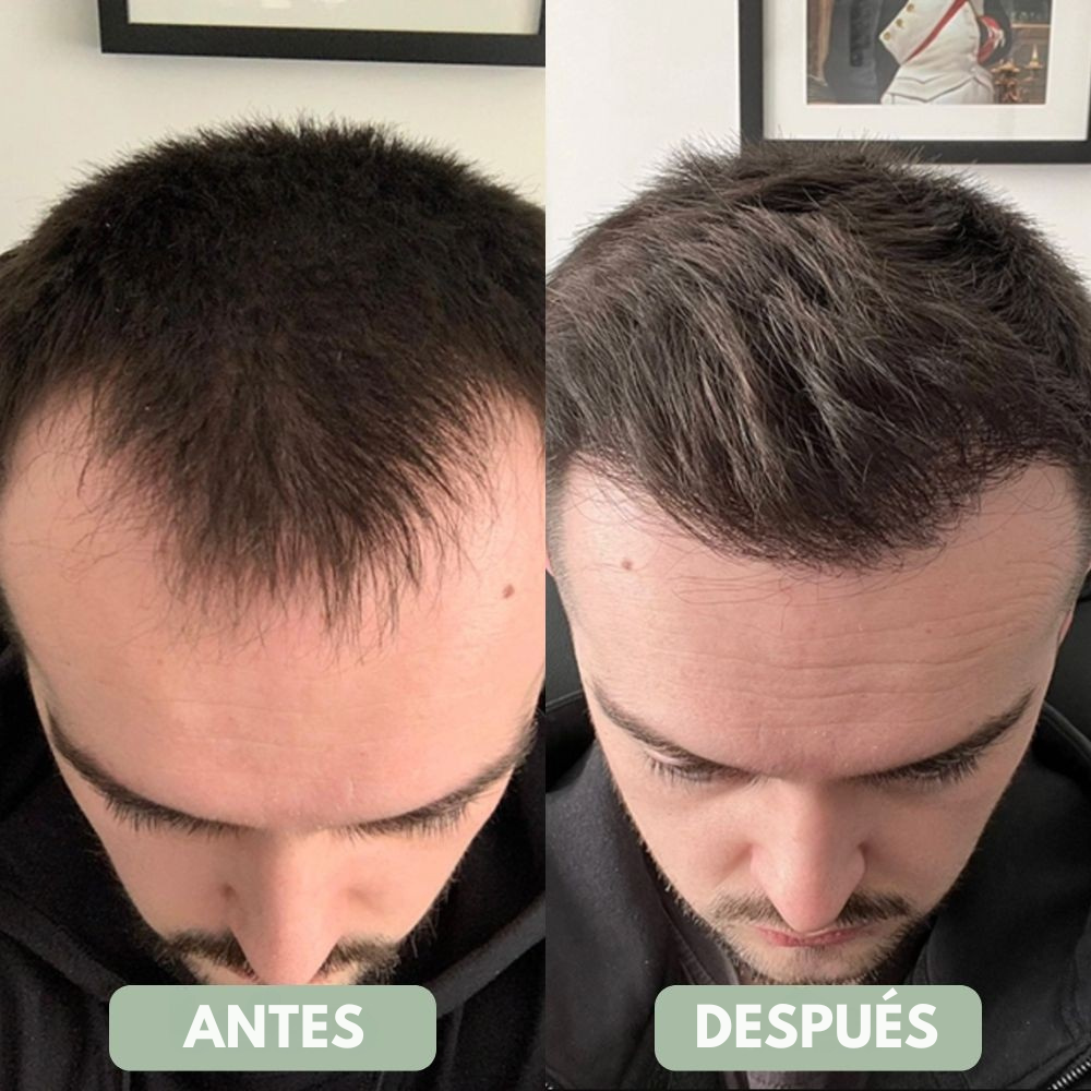 Bodywise™ Sérum para el Crecimiento del Cabello